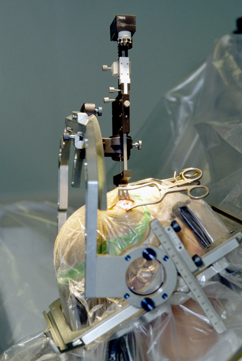 Operating room team performing breakthrough xenotransplantation surgery