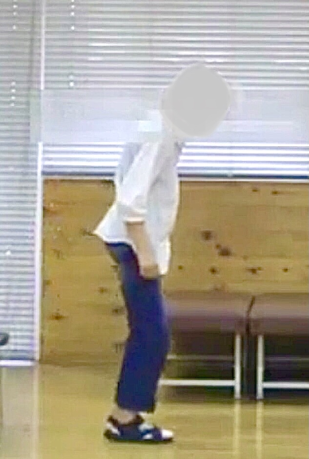 Patient exhibiting Parkinsonian gait in a clinical indoor setting