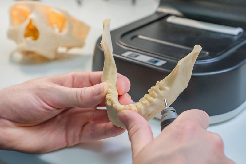 3D printing surgical model