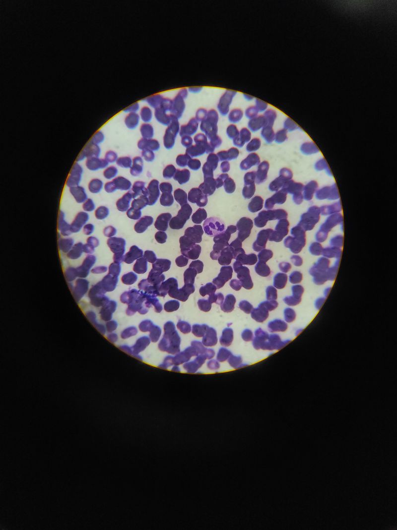 Blood cells under microscope