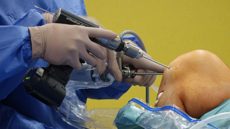 Bone surgery planning
