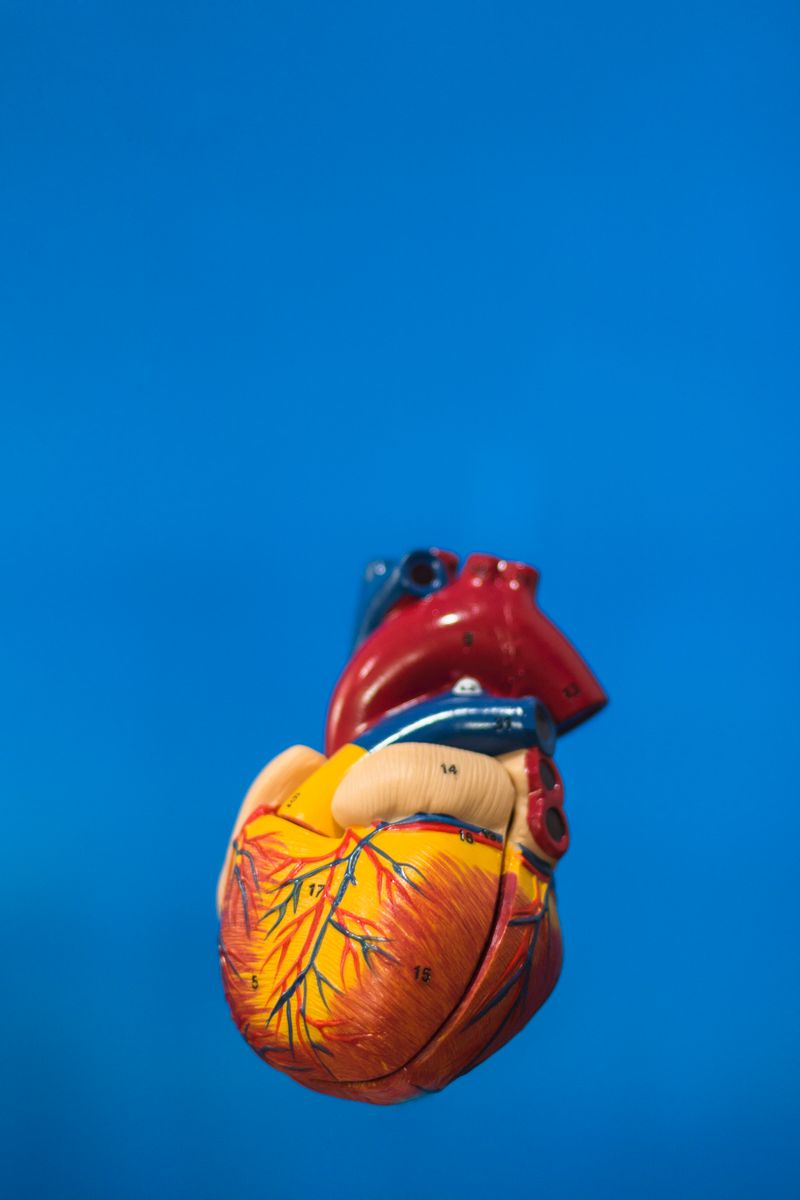 Cardiac surgery illustration showing aortic dissection repair procedure