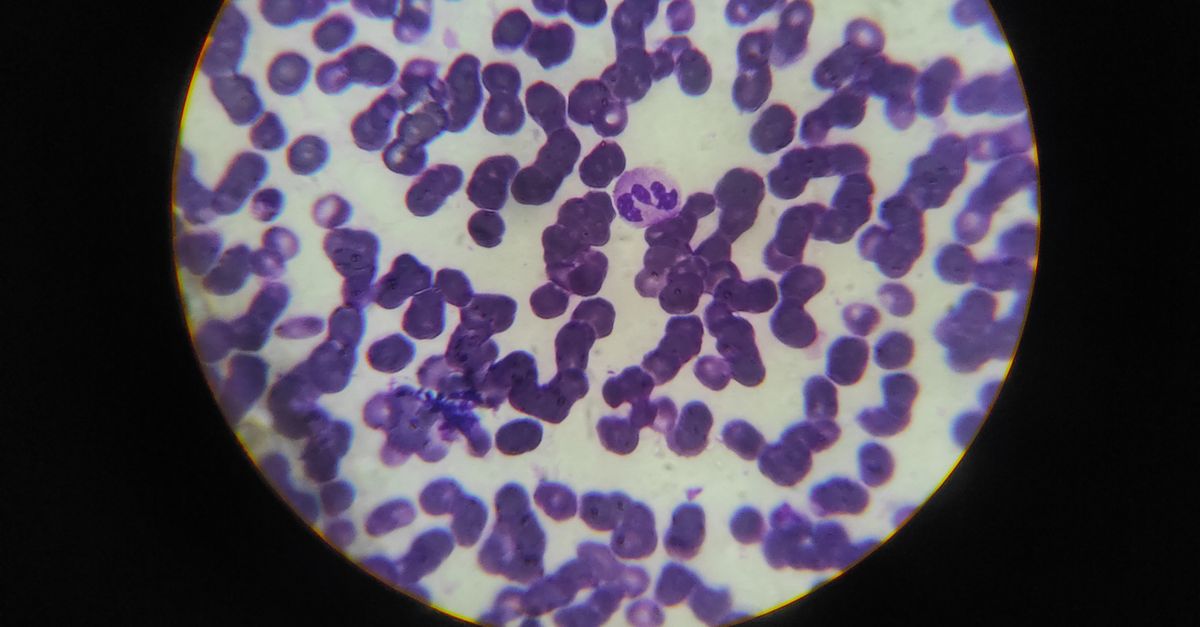 Innate lymphoid cells in intestinal tissue immune response