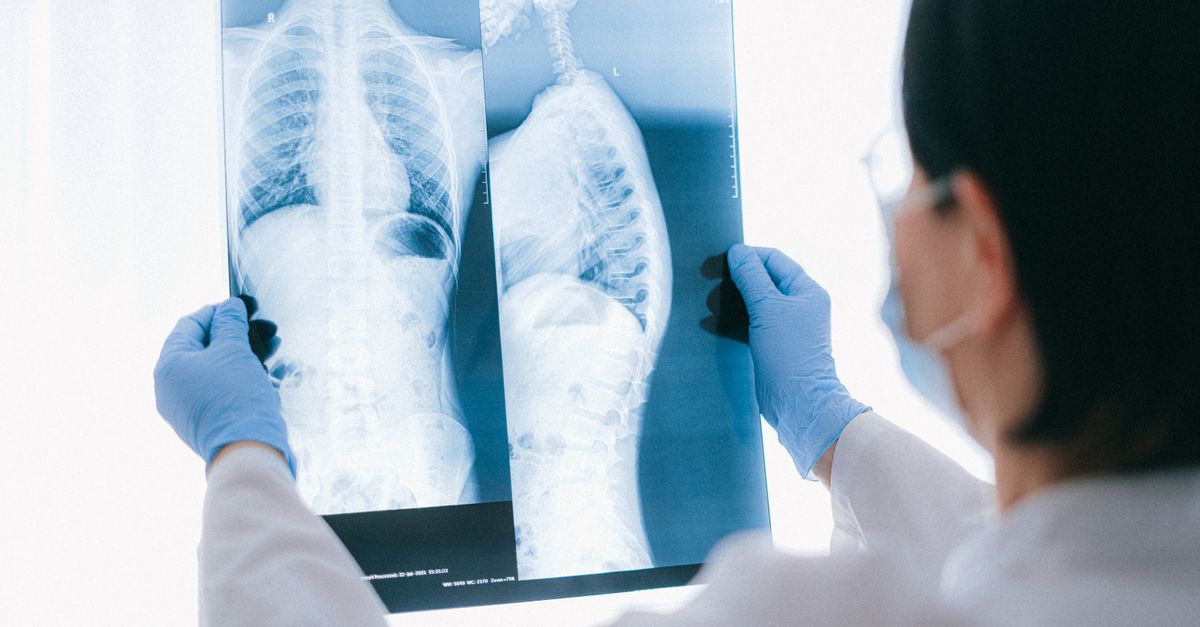 Thoracic surgery for lung cancer treatment