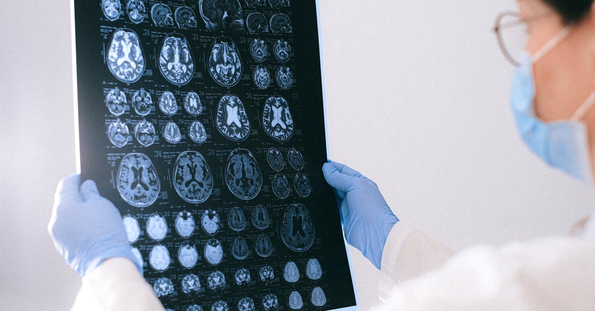 Brain MRI scan