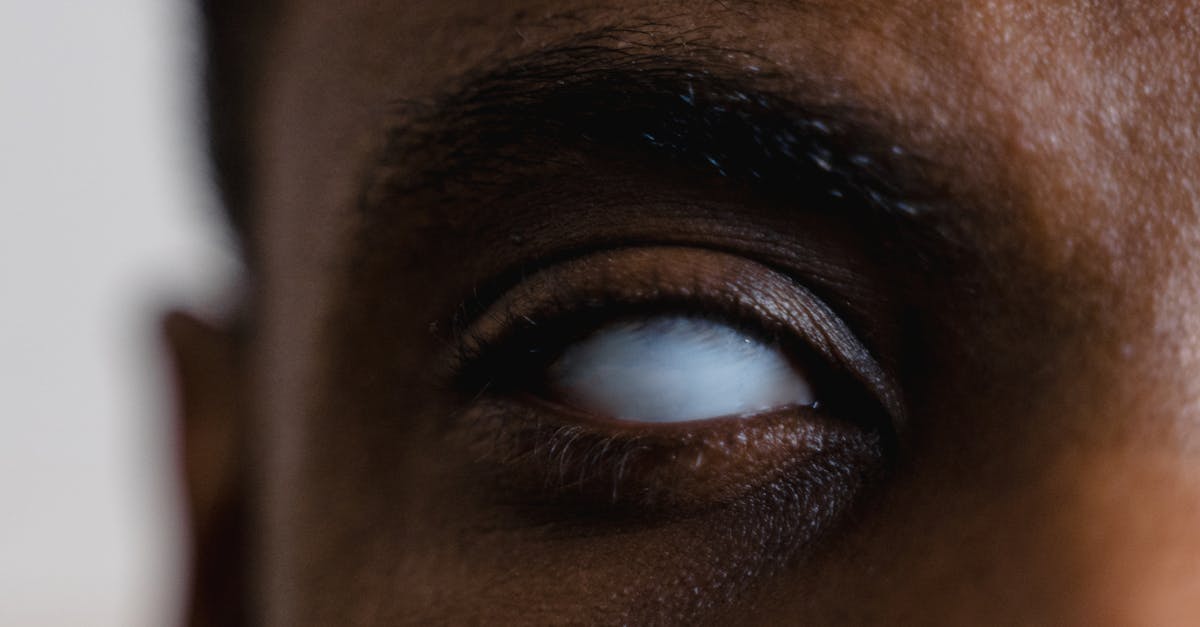Close-up of an eye showing vision impairment effects