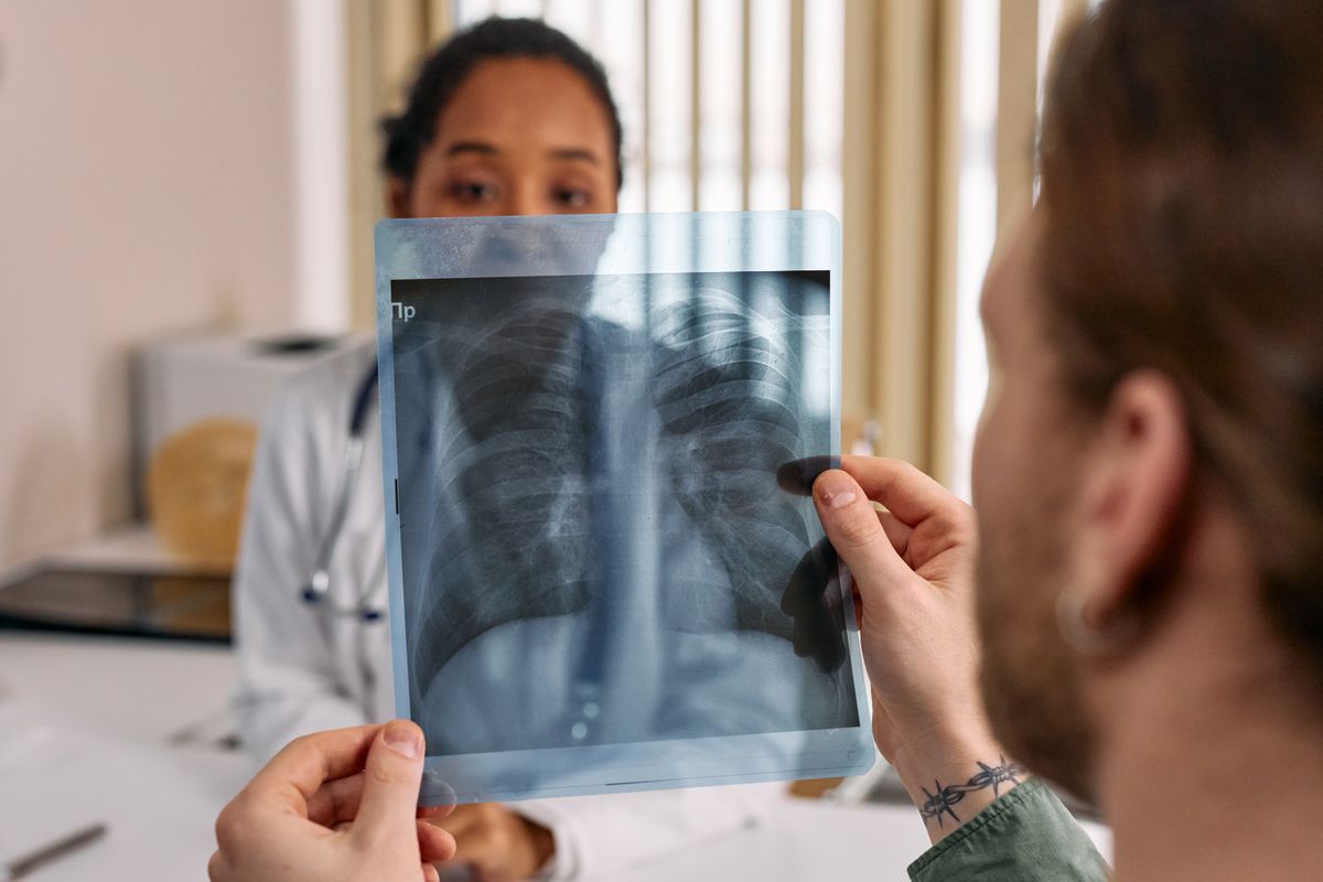 Doctor examining lung X-ray for cancer diagnosis